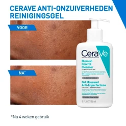 CeraVe Anti-Onzuiverheden Reinigingsgel