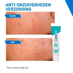 CeraVe Geconcentreerde Anti-Onzuiverheden Verzorging