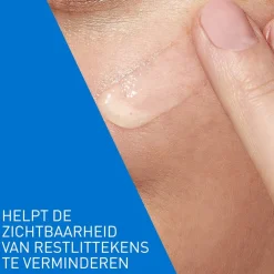 CeraVe Retinol Serum Tegen Post-Acne Vlekjes