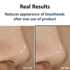 ISNTREE Hyper Acid4 AHA BHA PHA LHA 30 Serum