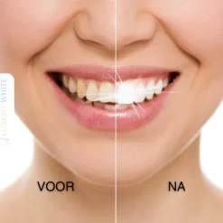 Luxury White Ultimate Whitening+