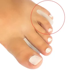 Medical Brace Siliconen Teenverdelers