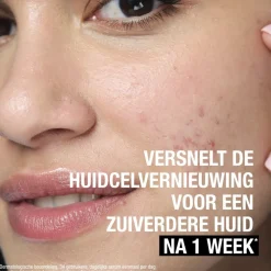 Neutrogena Anti-Puistjes+ 7% AHA + Panthenol Vloeibare Exfoliant