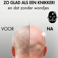 Sansbeauté Hoofdscheerapparaat + Extra Scheerkop - Skull Shaver - Pro Magnetic