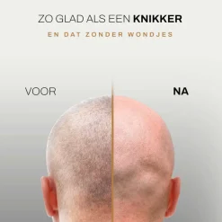 Sansbeauté Hoofdscheerapparaat - Skull Shaver - Skullsharp PRO