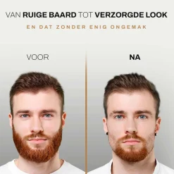 Sansbeauté 6-in-1 Baardtrimmer Met Opbergstandaard - Bodygroomer - Haartrimmer